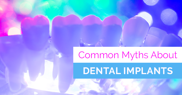 common dental implant misconceptions